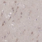 Anti-KCNJ9 antibody produced in rabbit Prestige Antibodies&#174; Powered by Atlas Antibodies, affinity isolated antibody