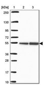 Anti-RBBP4 antibody produced in rabbit Prestige Antibodies&#174; Powered by Atlas Antibodies, affinity isolated antibody, buffered aqueous glycerol solution