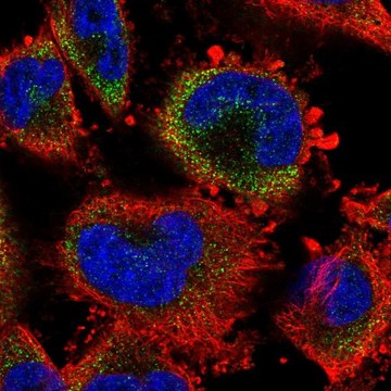 Anti-S100A3 antibody produced in rabbit Prestige Antibodies&#174; Powered by Atlas Antibodies, affinity isolated antibody