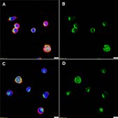 Anti-IL-5 Antibody, clone 1B20 ZooMAb&#174; Rabbit Monoclonal recombinant, expressed in HEK 293 cells