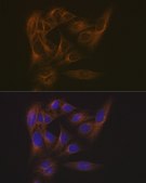 Anti-EB3/MAPRE3 antibody produced in rabbit