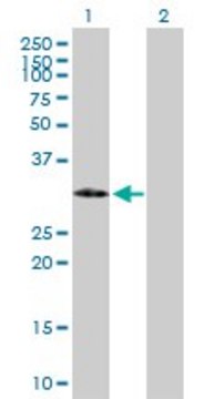 Anti-IGFBP2 antibody produced in mouse purified immunoglobulin, buffered aqueous solution