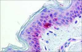 Anti-RAE1 (AB1) antibody produced in rabbit affinity isolated antibody