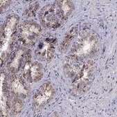 Anti-ANGPT1 antibody produced in rabbit Prestige Antibodies&#174; Powered by Atlas Antibodies, affinity isolated antibody, buffered aqueous glycerol solution, Ab1