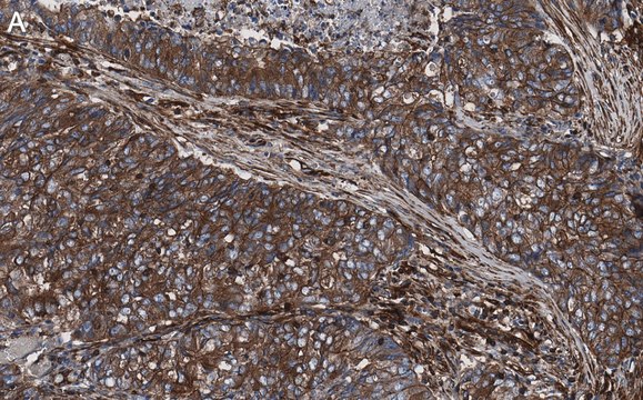 Anti-p-Myosin LC 2 (Ser19) Antibody, clone 2C10 ZooMAb&#174; Rabbit Monoclonal recombinant, expressed in HEK 293 cells