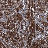 Anti-MYLK antibody produced in rabbit Prestige Antibodies&#174; Powered by Atlas Antibodies, affinity isolated antibody, buffered aqueous glycerol solution