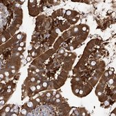 Anti-FABP2 antibody produced in rabbit Prestige Antibodies&#174; Powered by Atlas Antibodies, affinity isolated antibody, buffered aqueous glycerol solution