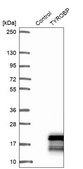 Anti-TYROBP antibody produced in rabbit Prestige Antibodies&#174; Powered by Atlas Antibodies, affinity isolated antibody, buffered aqueous glycerol solution