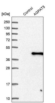 Anti-AGPAT5 antibody produced in rabbit Prestige Antibodies&#174; Powered by Atlas Antibodies, affinity isolated antibody, buffered aqueous glycerol solution