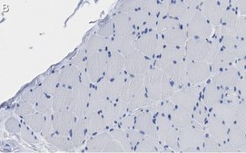 Anti-Fibroblast Antibody, clone TE-7 ZooMAb&#174; Mouse Monoclonal recombinant, expressed in HEK 293 cells
