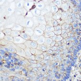 Anti-beta 2 Microglobulin Antibody, clone 5F0O7, Rabbit Monoclonal
