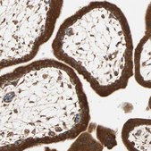 Anti-EIF4G2 antibody produced in rabbit Prestige Antibodies&#174; Powered by Atlas Antibodies, affinity isolated antibody, buffered aqueous glycerol solution, Ab1