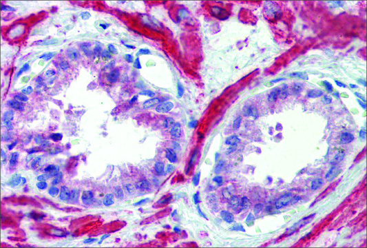 Anti-IGFBP4 antibody produced in rabbit affinity isolated antibody