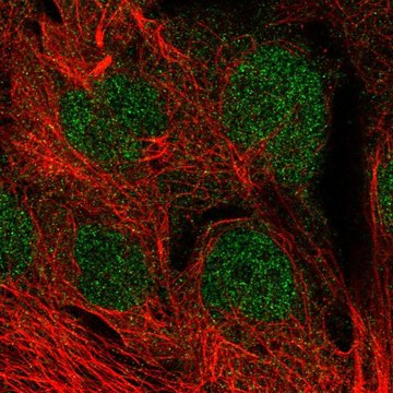 Anti-MGMT antibody produced in rabbit Prestige Antibodies&#174; Powered by Atlas Antibodies, affinity isolated antibody