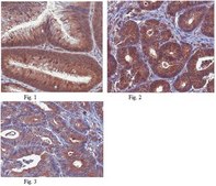 Anti-Beclin-1 Antibody, clone 9A1.1 clone 9A1.1, from mouse