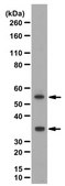 Anti-PD-L1 Antibody/CD274 1&#160;mg/mL, from rabbit
