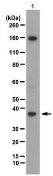 Anti-JMJD8 Antibody from rabbit, purified by affinity chromatography