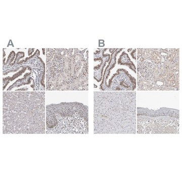 Anti-WRAP53 antibody produced in rabbit Prestige Antibodies&#174; Powered by Atlas Antibodies, affinity isolated antibody, buffered aqueous glycerol solution