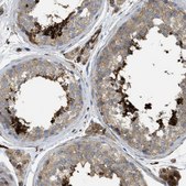 Anti-HIP1 antibody produced in rabbit Prestige Antibodies&#174; Powered by Atlas Antibodies, affinity isolated antibody, buffered aqueous glycerol solution