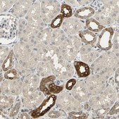 Anti-ACSL4 antibody produced in rabbit Prestige Antibodies&#174; Powered by Atlas Antibodies, affinity isolated antibody, buffered aqueous glycerol solution