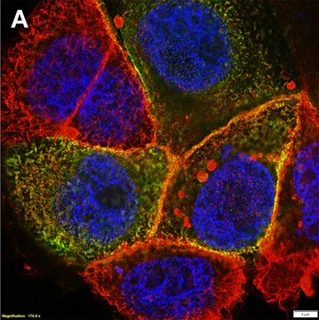 Anti-CFTR Antibody, clone MM13-4 ZooMAb&#174; Mouse Monoclonal recombinant, expressed in HEK 293 cells