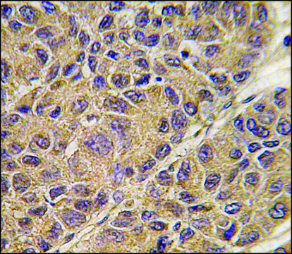 Anti-APOC3 (C-term) antibody produced in rabbit saturated ammonium sulfate (SAS) precipitated, buffered aqueous solution