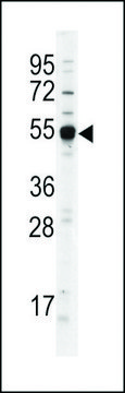 ANTI-DNMT2 antibody produced in rabbit IgG fraction of antiserum, buffered aqueous solution
