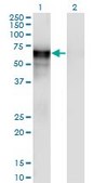 Monoclonal Anti-PSAP antibody produced in mouse clone 2F6, purified immunoglobulin, buffered aqueous solution