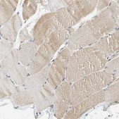 Anti-RPS6KA1 antibody produced in rabbit Prestige Antibodies&#174; Powered by Atlas Antibodies, affinity isolated antibody, buffered aqueous glycerol solution