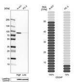 Anti-CD2AP antibody produced in rabbit Ab1, Prestige Antibodies&#174; Powered by Atlas Antibodies, affinity isolated antibody, buffered aqueous glycerol solution