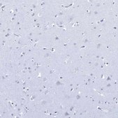 Anti-DLK1 antibody produced in rabbit Prestige Antibodies&#174; Powered by Atlas Antibodies, affinity isolated antibody, buffered aqueous glycerol solution