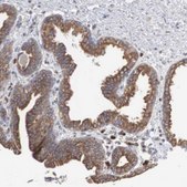Anti-CTAGE5 antibody produced in rabbit Prestige Antibodies&#174; Powered by Atlas Antibodies, affinity isolated antibody, buffered aqueous glycerol solution
