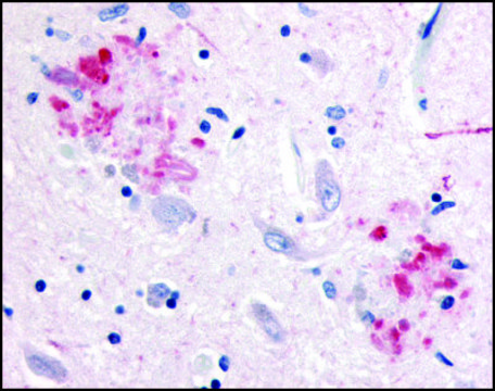 Anti-APP antibody produced in rabbit affinity isolated antibody, buffered aqueous solution