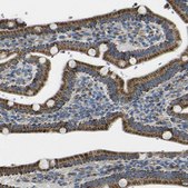 Anti-ALDH18A1 antibody produced in rabbit Prestige Antibodies&#174; Powered by Atlas Antibodies, affinity isolated antibody, buffered aqueous glycerol solution