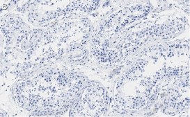 Anti-PER2 Antibody, clone 1G17 ZooMAb&#174; Rabbit Monoclonal recombinant, expressed in HEK 293 cells