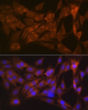 Anti-CLEC3B/Tetranectin antibody produced in rabbit
