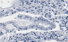 Anti-phospho-Chk2-Thr68 Antibody, clone 1B17 ZooMAb&#174; Rabbit Monoclonal recombinant, expressed in HEK 293 cells