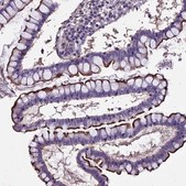 Anti-USB1 antibody produced in rabbit Prestige Antibodies&#174; Powered by Atlas Antibodies, affinity isolated antibody, buffered aqueous glycerol solution