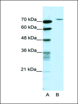 Anti-TAF6 (AB1) antibody produced in rabbit IgG fraction of antiserum