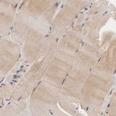 Anti-ADSL antibody produced in rabbit Prestige Antibodies&#174; Powered by Atlas Antibodies, affinity isolated antibody, buffered aqueous glycerol solution