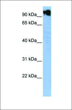 Anti-ZFY antibody produced in rabbit affinity isolated antibody