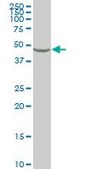 Monoclonal Anti-ENO1 antibody produced in mouse clone 3C8, purified immunoglobulin, buffered aqueous solution