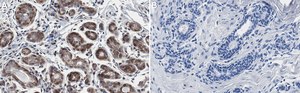 Anti-IGF-1R β Antibody, clone 1D18 ZooMAb&#174; Rabbit Monoclonal recombinant, expressed in HEK 293 cells