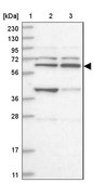 Anti-ZNF500 antibody produced in rabbit Prestige Antibodies&#174; Powered by Atlas Antibodies, affinity isolated antibody, buffered aqueous glycerol solution