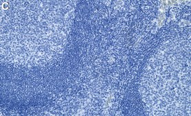 Anti-TYMS Antibody, clone 1E20 ZooMAb&#174; Rabbit Monoclonal recombinant, expressed in HEK 293 cells
