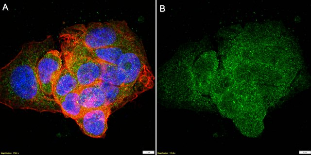 Anti-HSD17B13 Antibody, clone 2B3 ZooMAb&#174; Rabbit Monoclonal recombinant, expressed in HEK 293 cells
