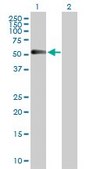 Anti-CHRDL1 antibody produced in rabbit purified immunoglobulin, buffered aqueous solution