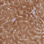 Anti-ALDH8A1 antibody produced in rabbit Prestige Antibodies&#174; Powered by Atlas Antibodies, affinity isolated antibody, buffered aqueous glycerol solution