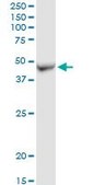 Anti-ADHFE1 antibody produced in rabbit purified immunoglobulin, buffered aqueous solution