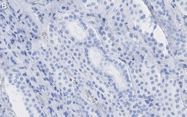 Anti-Selenoprotein P Antibody, clone 2G23 ZooMAb&#174; Rabbit Monoclonal recombinant, expressed in HEK 293 cells